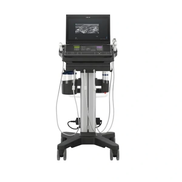 sono Sonosite ZX | FUJIFILM Sonosite